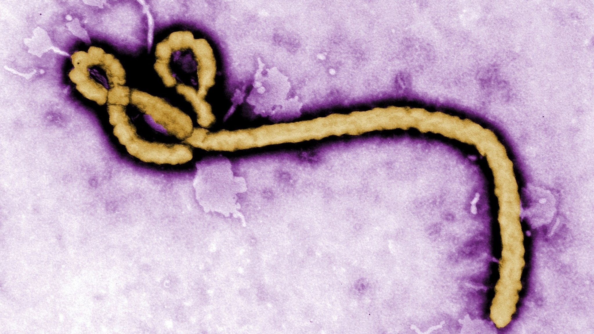 Die Aufnahme eines Elektronenmikroskops zeigt ein einzelnes Viruspartikel des Ebola-Virus.