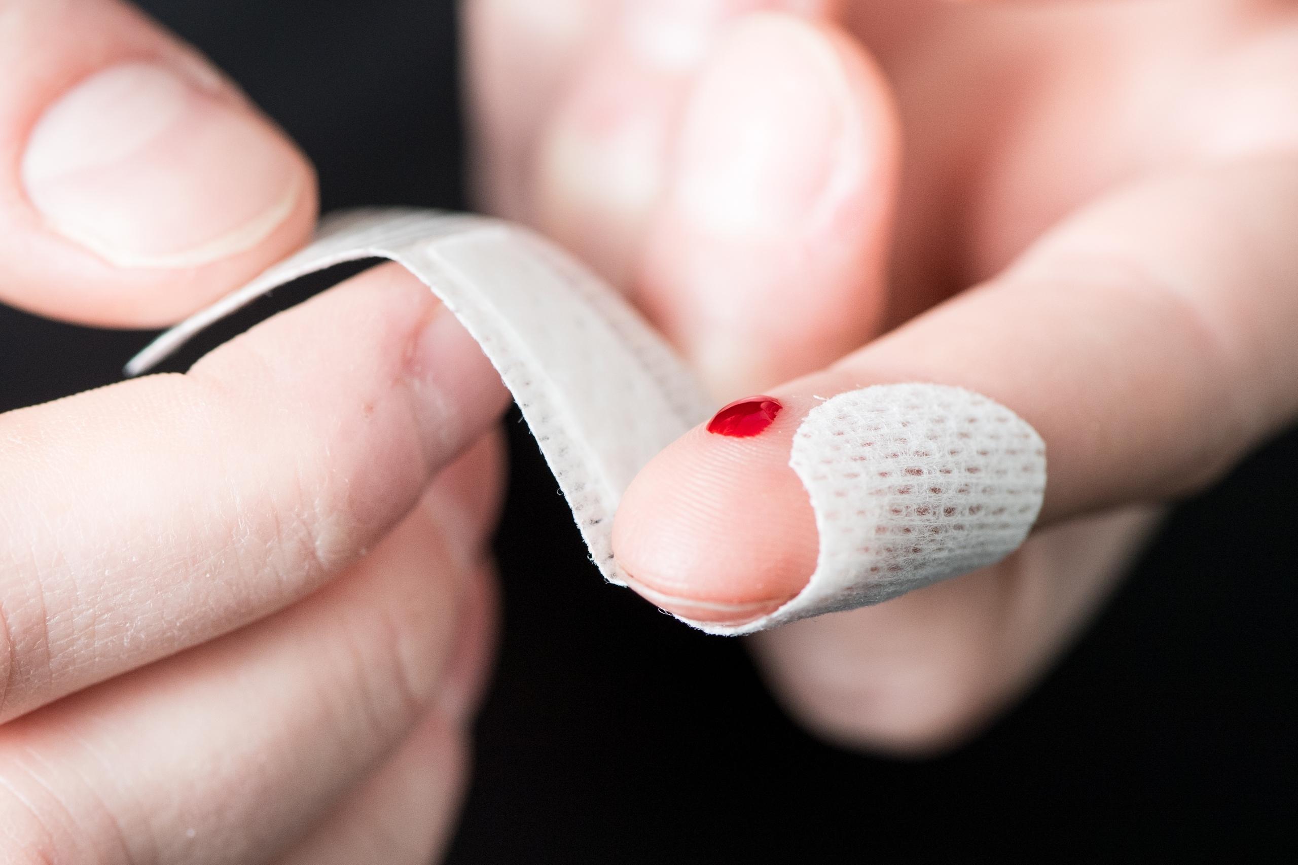 Ein Finger mit einer kleinen blutenden Wunde, um die ein Pflaster gewickelt wird