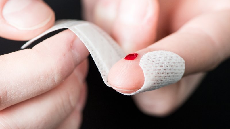 Ein Finger mit einer kleinen blutenden Wunde, um die ein Pflaster gewickelt wird | Bild: picture-alliance/dpa Ein Finger mit einer kleinen blutenden Wunde, um die ein Pflaster gewickelt wird