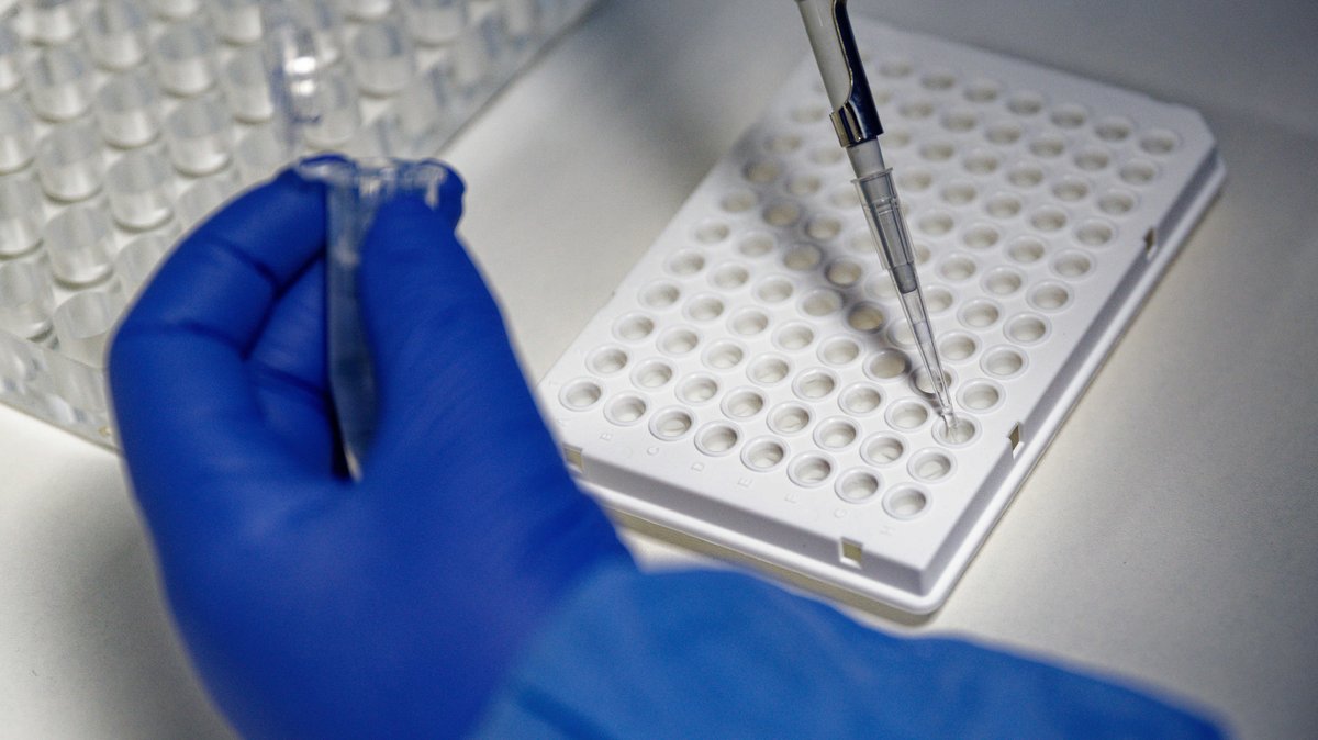 Eine Labor-Mitarbeiterin füllt mit einer Pipette zur Vorbereitung von PCR-Tests eine Testflüssigkeit in einer Trägerplatte