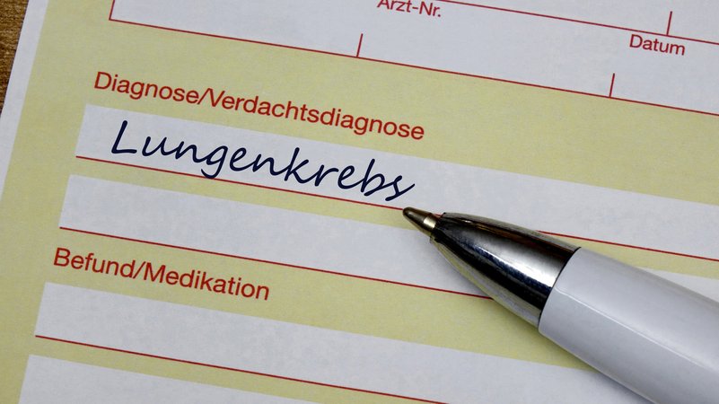 Auf einem Krankenschein mit der (Verdachts-)Diagnose Lungenkrebs liegt ein Kugelschreiber (Symbolbild). | Bild: picture alliance / ZB | Sascha Steinach Auf einem Krankenschein mit der (Verdachts-)Diagnose Lungenkrebs liegt ein Kugelschreiber (Symbolbild).