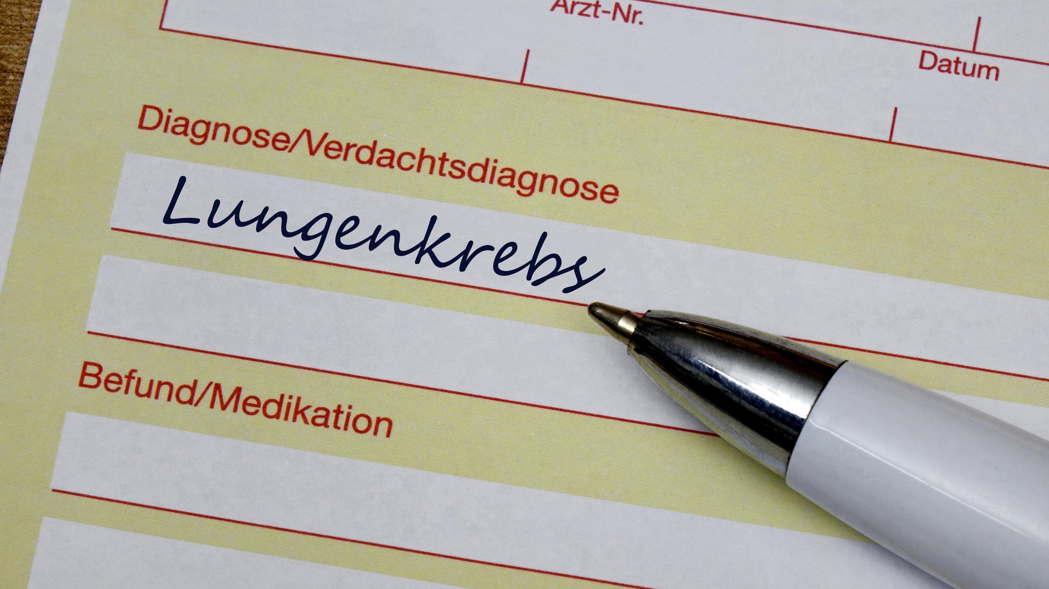 Auf einem Krankenschein mit der (Verdachts-)Diagnose Lungenkrebs liegt ein Kugelschreiber (Symbolbild).