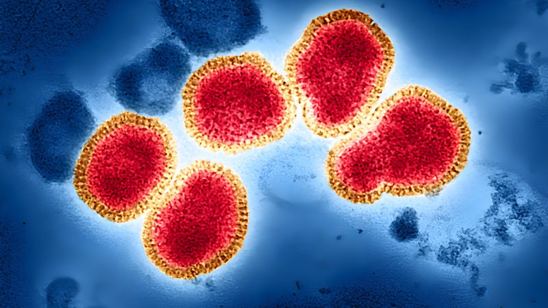 Influenzavirus-Partikel (A/H3N2) unter dem Elektronenmikroskop | Bild: picture alliance / BSIP | NIH-NIAID / IMAGE POINT FR Influenzavirus-Partikel (A/H3N2) unter dem Elektronenmikroskop