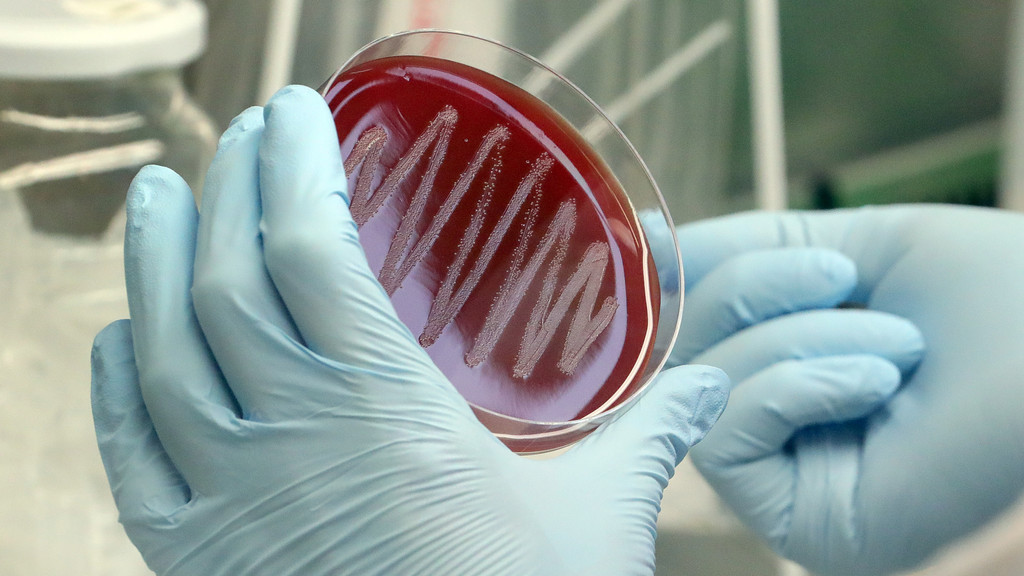 Eine Mikrobiologin nimmt im Max-Planck-Institut für Infektionsbiologie das Picken einer Bakterienkolonie (Streptococcus pyogenes) auf eine Blutagarplatte vor.