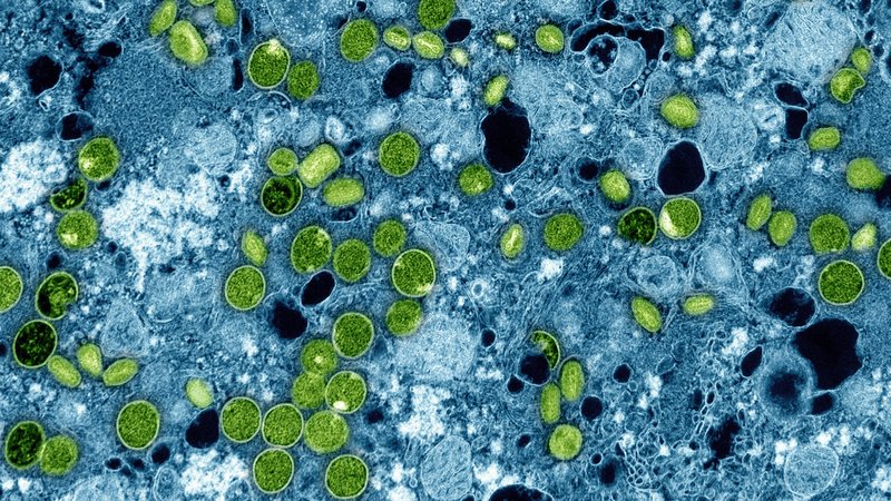 Diese kolorierte elektronenmikroskopische Aufnahme des National Institute of Allergy and Infectious Diseases aus dem Jahr 2024 zeigt Mpox-Viruspartikel (grün), die sich in infizierten kultivierten Zellen (blau) befinden. Die Viruspartikel befinden sich in verschiedenen Reifestadien, was zu Unterschieden in der Form führt. | Bild: dpa-Bildfunk Diese kolorierte elektronenmikroskopische Aufnahme des National Institute of Allergy and Infectious Diseases aus dem Jahr 2024 zeigt Mpox-Viruspartikel (grün), die sich in infizierten kultivierten Zellen (blau) befinden. Die Viruspartikel befinden sich in verschiedenen Reifestadien, was zu Unterschieden in der Form führt.