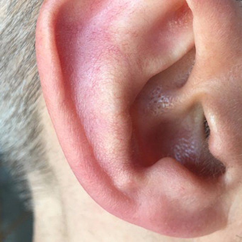 Hören Sie noch gut? Zum Tag gegen den Lärm - Gesundheitsgespräch | BR Podcast