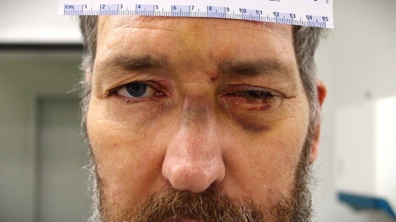 Der frühere Häftling der JVA Gablingen, Gunter E. | Bild: BR / Herz Der frühere Häftling der JVA Gablingen, Gunter E.