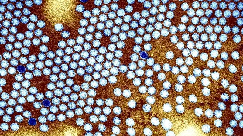 Elektronenmikroskopische Aufnahme des Polio-Virus | Bild: picture-alliance / BSIP/CDC/MURPHY-WHITFIELD | CDC/MURPHY-WHITFIELD Elektronenmikroskopische Aufnahme des Polio-Virus