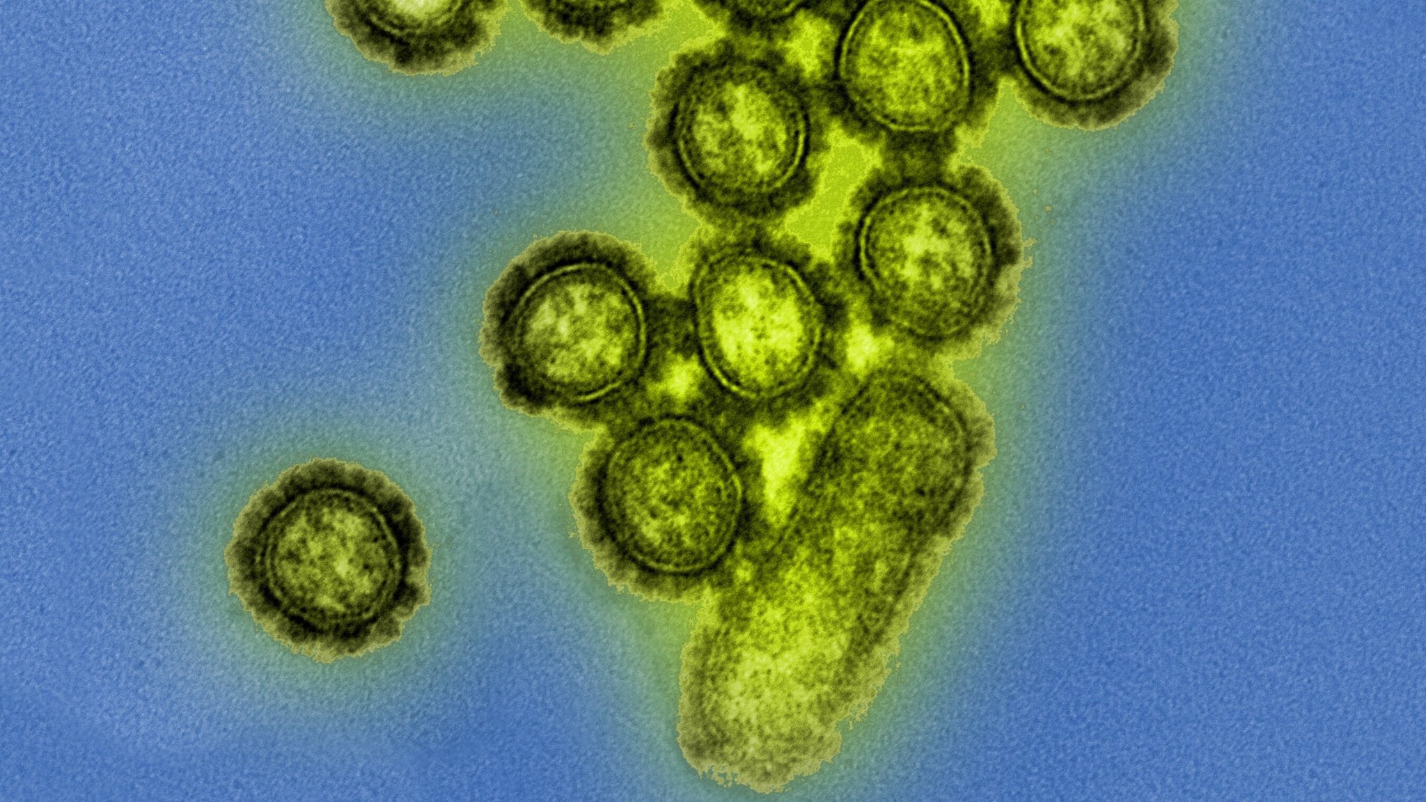 H1N1 unter dem Elektronenmikroskop: Der Influenza-Subtyp spielt in der aktuellen Grippe- und Erkältungssaison eine wichtige Rolle. | Bild: picture alliance / BSIP | IMAGE POINT FR / NIH / NIAID H1N1 unter dem Elektronenmikroskop: Der Influenza-Subtyp spielt in der aktuellen Grippe- und Erkältungssaison eine wichtige Rolle.