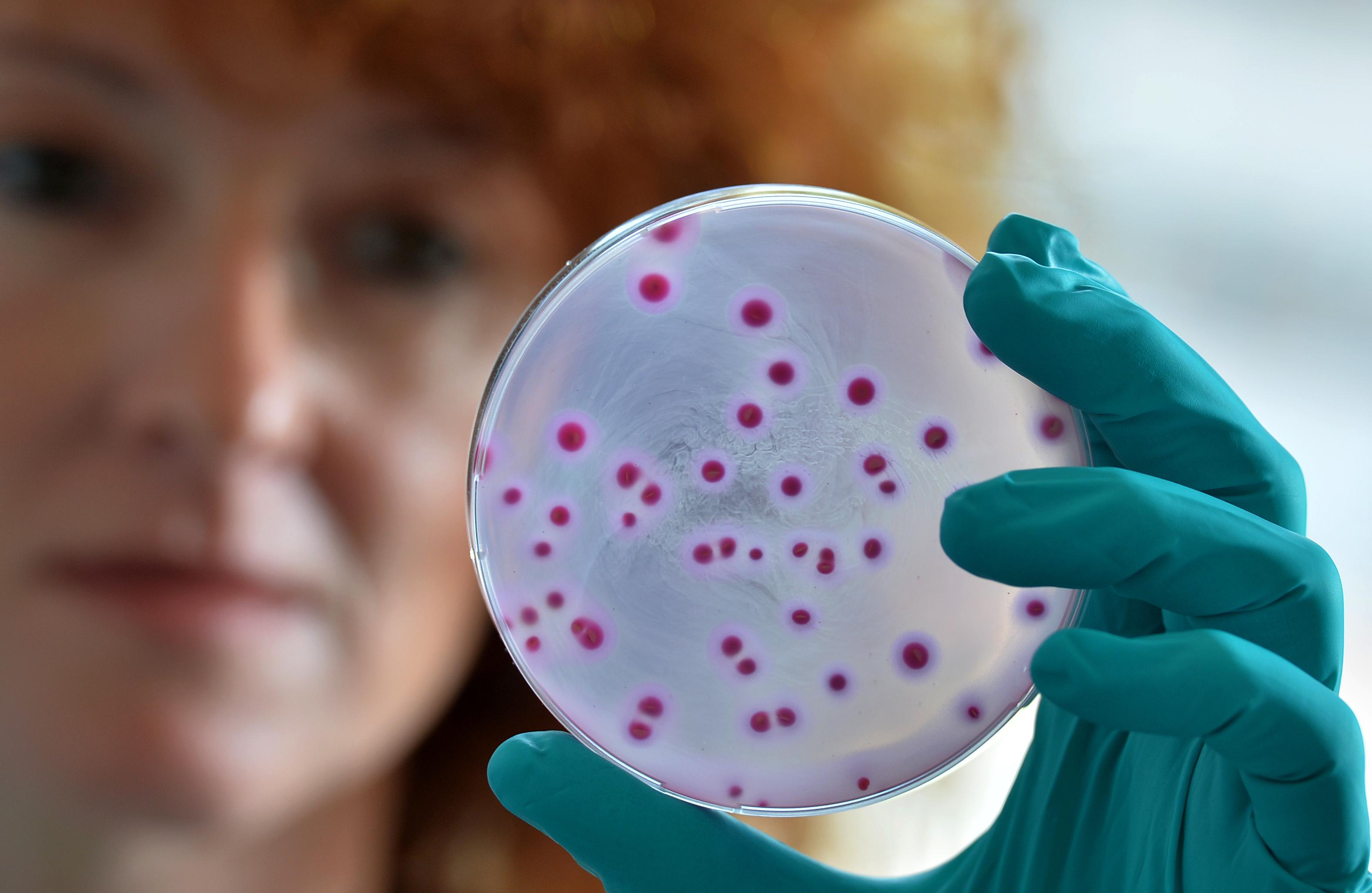 Eine Frau hält eine Schale mit einem speziellen Nährboden für Escherichia coli Bakterien