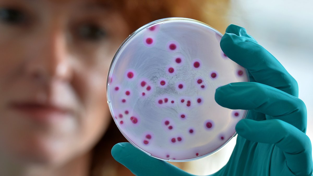 Eine Frau hält eine Schale mit einem speziellen Nährboden für Escherichia coli Bakterien