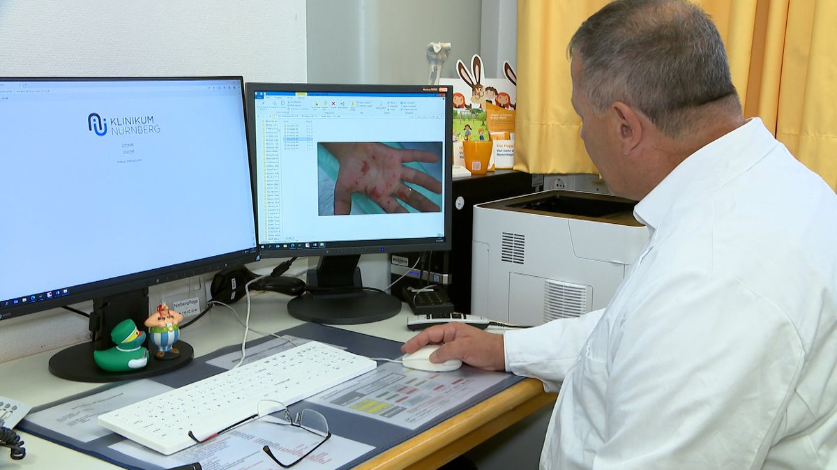 Ein Kinderarzt schaut sich die Verletzungen eines Kindes durch Feuerwerkskörper am Computer an.