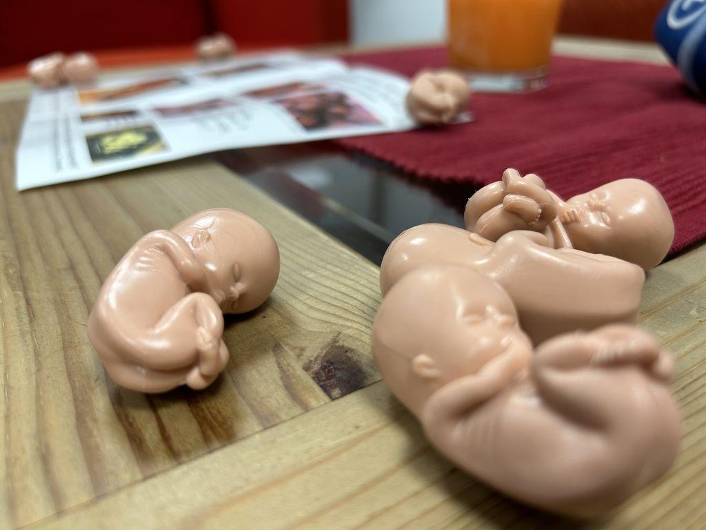 Plastikföten im Treppenhaus von Pro Familia in Passau.