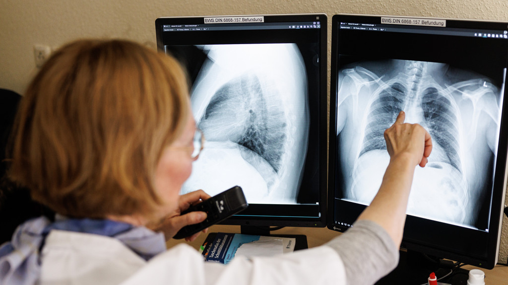 Eine Frau (Sicht von hinten) weist mit dem Finger auf einen Monitor, auf dem Röntgenbilder einer Lunge zu sehen sind.