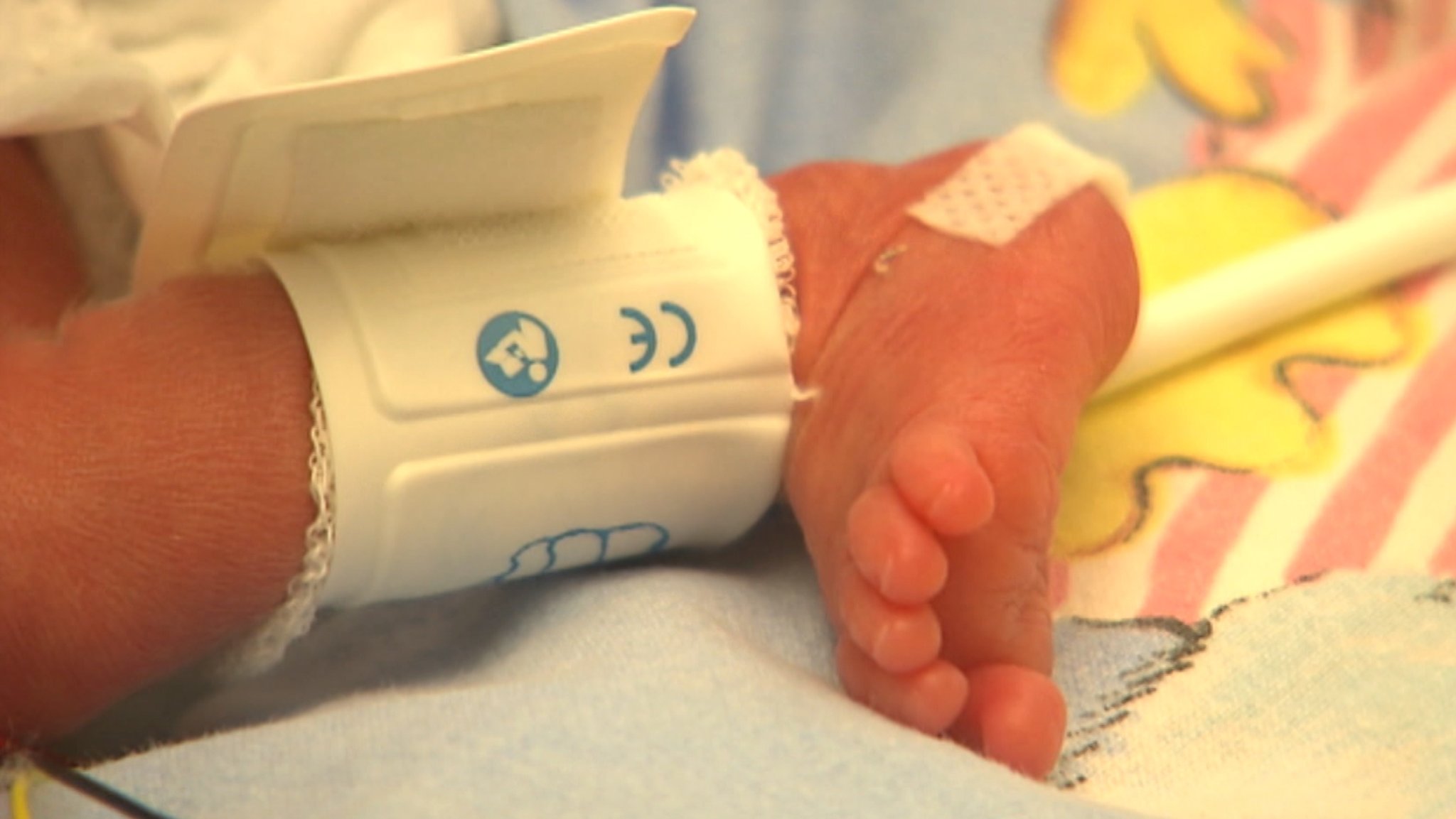 Ein Kind im Krankenhaus. | Bild: BR Ein Kind im Krankenhaus.