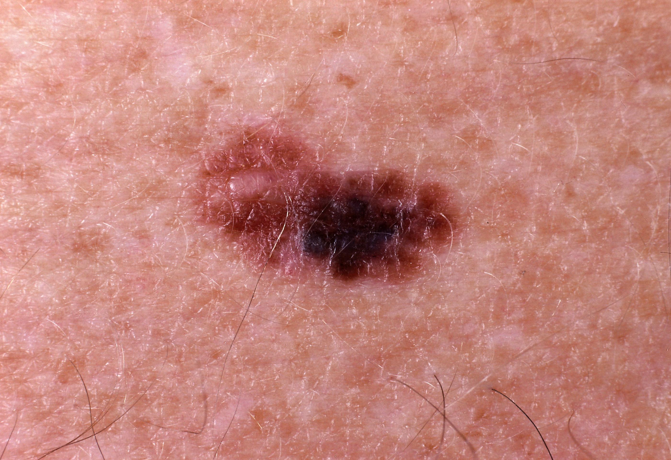 BR Bayerischer Rundfunk Nachrichten von BR24, Highlights aus der BR