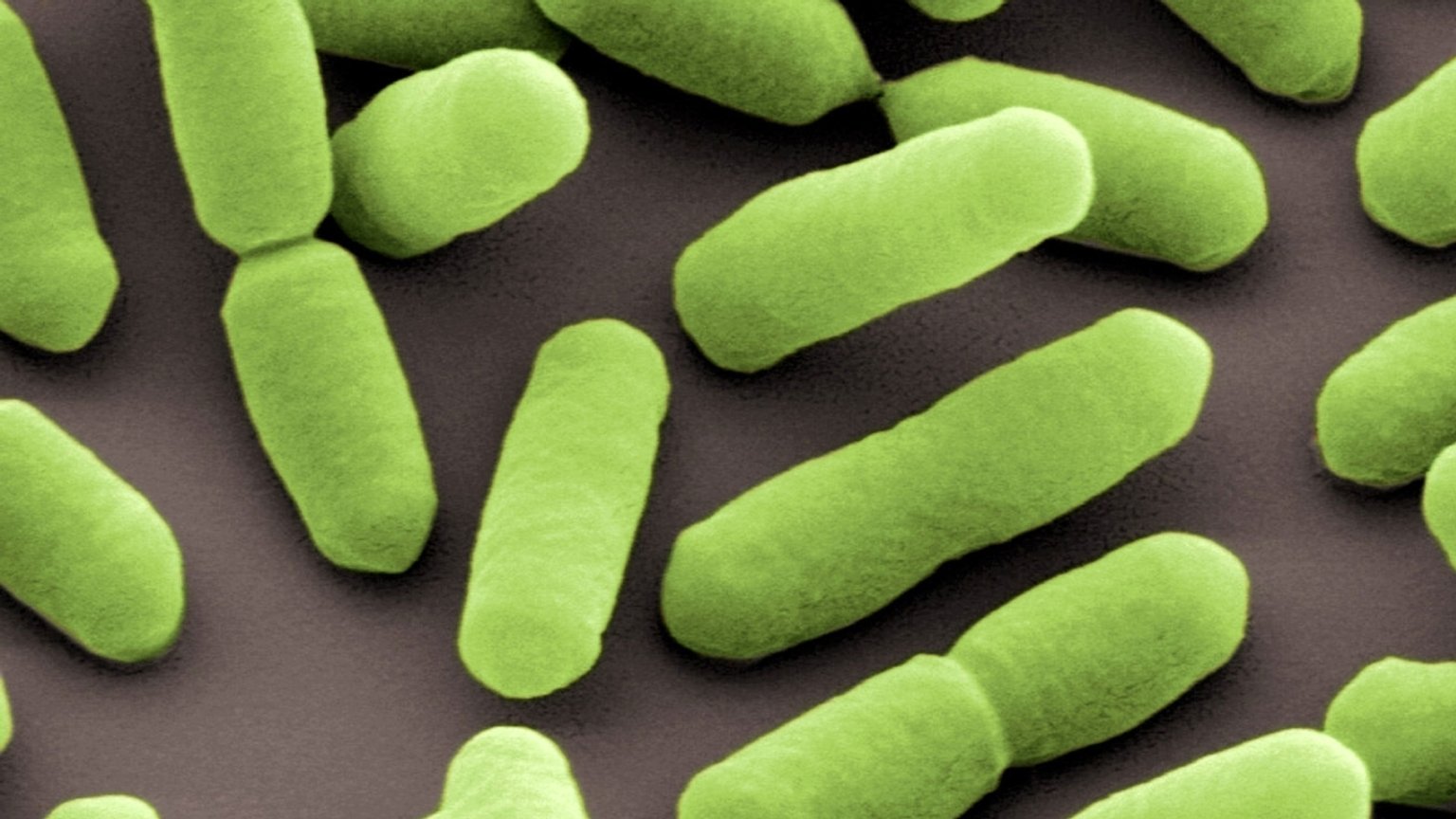 Wie Steckt Man Sich Mit Norovirus An www.br.de