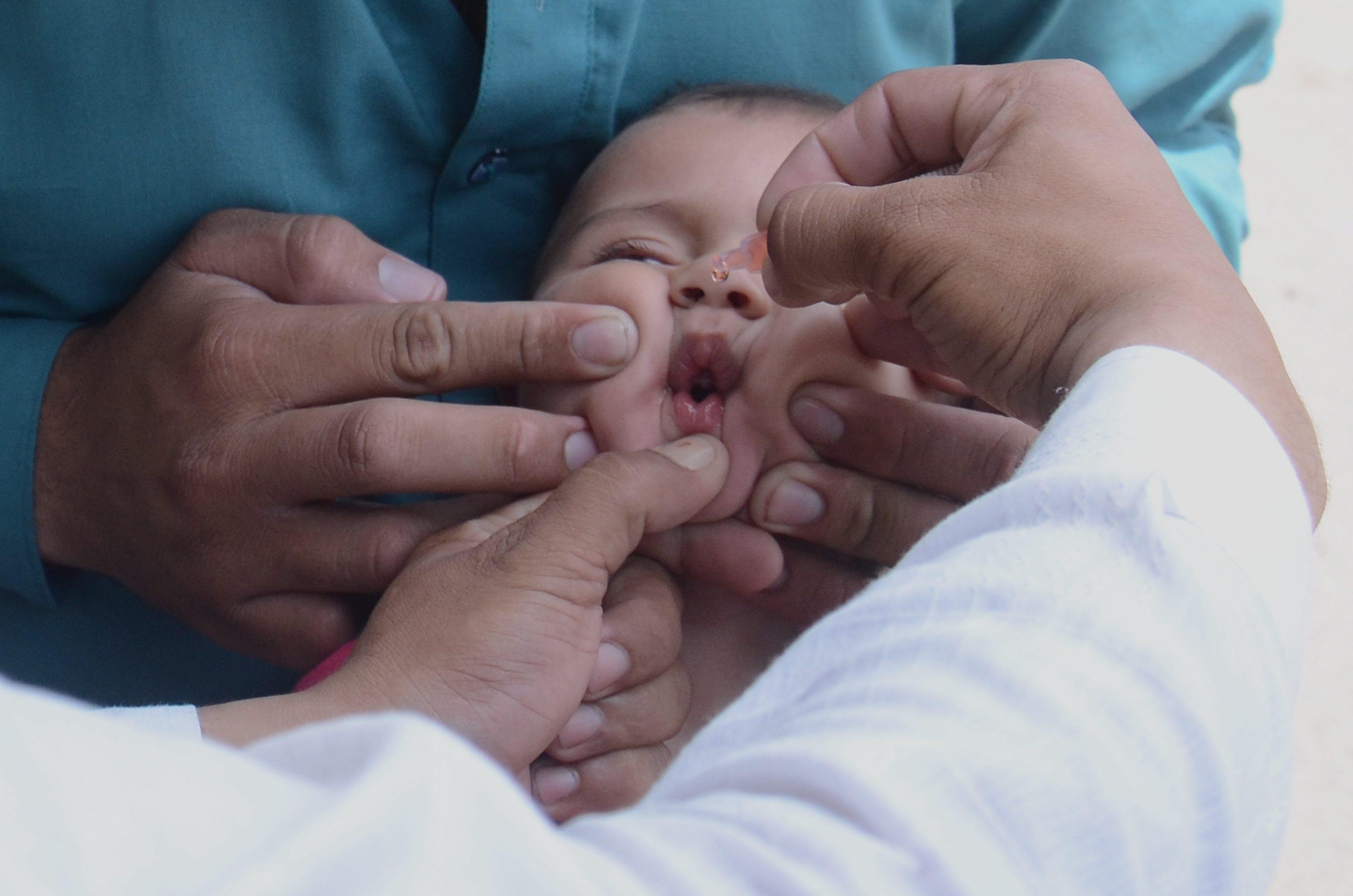 Ein Baby bekommt eine Schluckimpfung gegen Polio, also Kinderlähmung