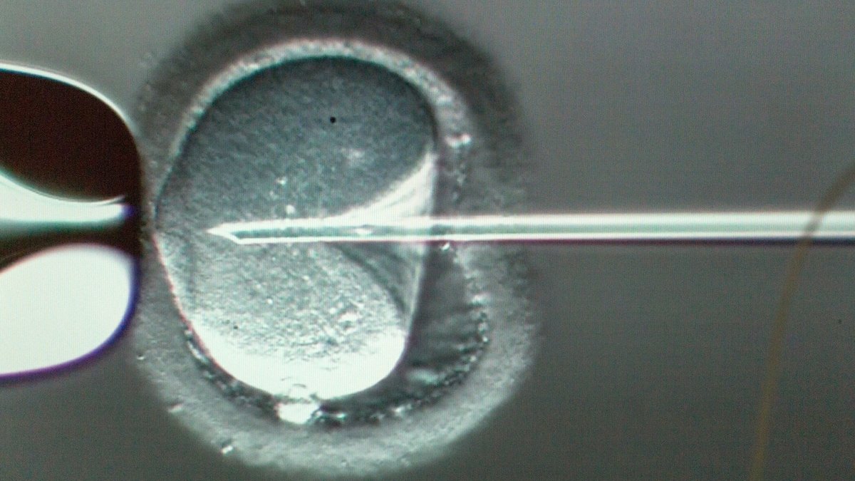 Injektion eines Spermiums in eine Eizelle