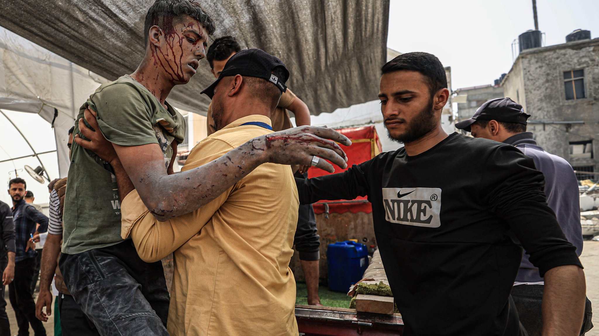 17.05.2025: Durch Israelische Angriffe verletzte Palästinenser werden in das al-Ahli-Baptist-Krankenhaus im Gazastreifen gebracht.