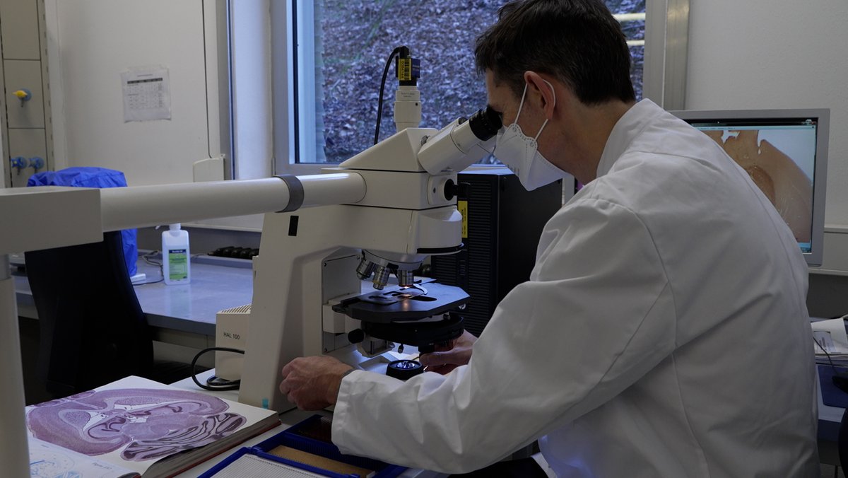 Private Stiftung fördert Forschung gegen Tumor – Erste Erfolge