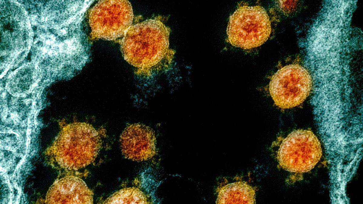 Partikel des Coronavirus SARS-CoV-2, die von einem Patienten isoliert wurden