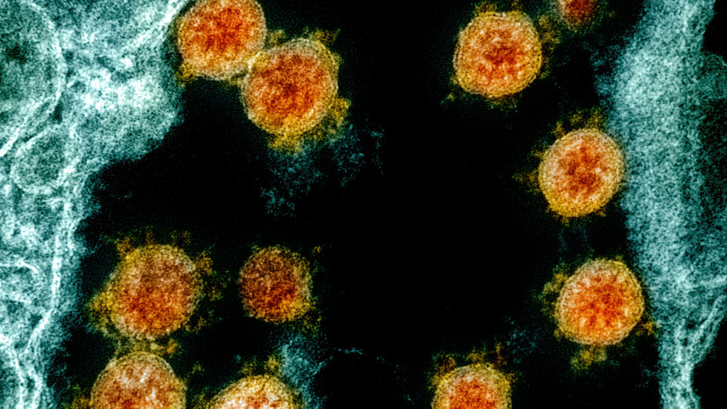 Partikel des Coronavirus SARS-CoV-2, die von einem Patienten isoliert wurden | Bild: dpa Partikel des Coronavirus SARS-CoV-2, die von einem Patienten isoliert wurden