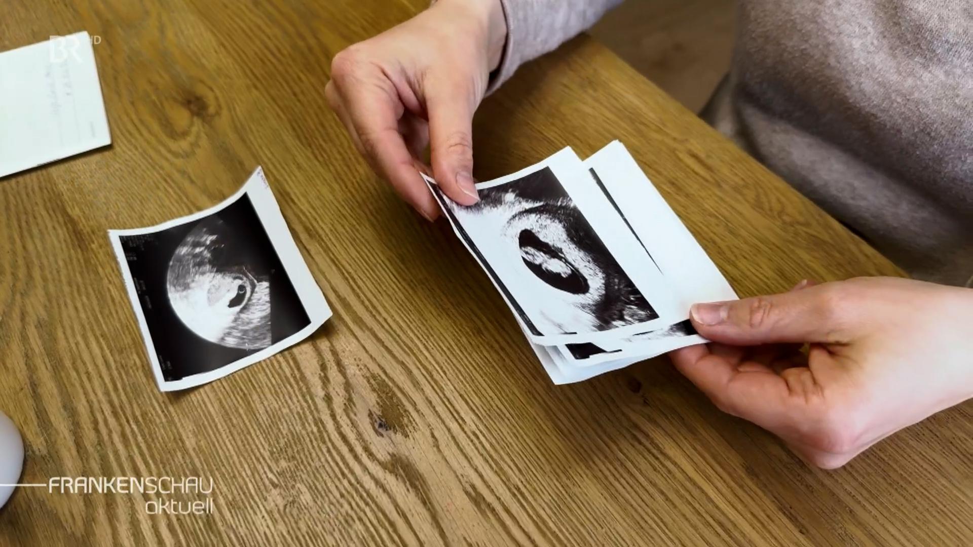 Ultraschallbilder einer Schwangerschaft