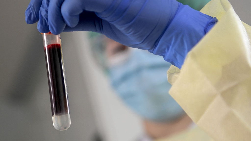 Labormitarbeiter mit Blutprobe