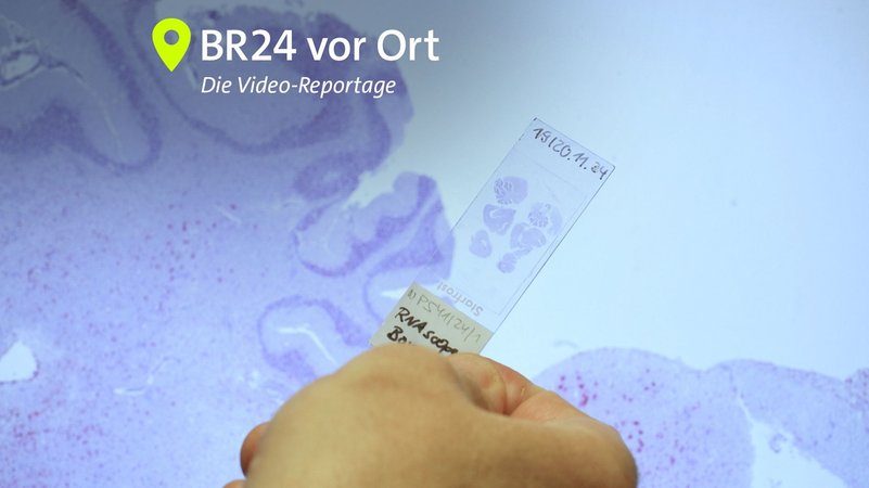 Extrem selten, extrem gefährlich: Das Bornavirus | Bild: BR / Nadine Cibu / Ferdinand Spes Extrem selten, extrem gefährlich: Das Bornavirus