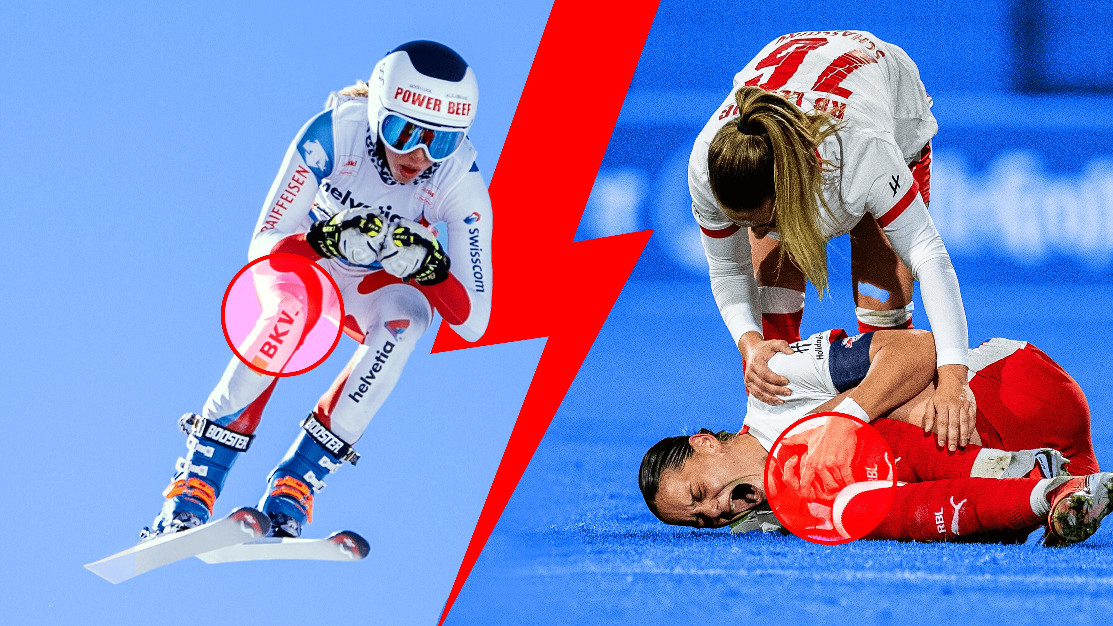 Reportage: Wer stoppt die Kreuzbandrisse?