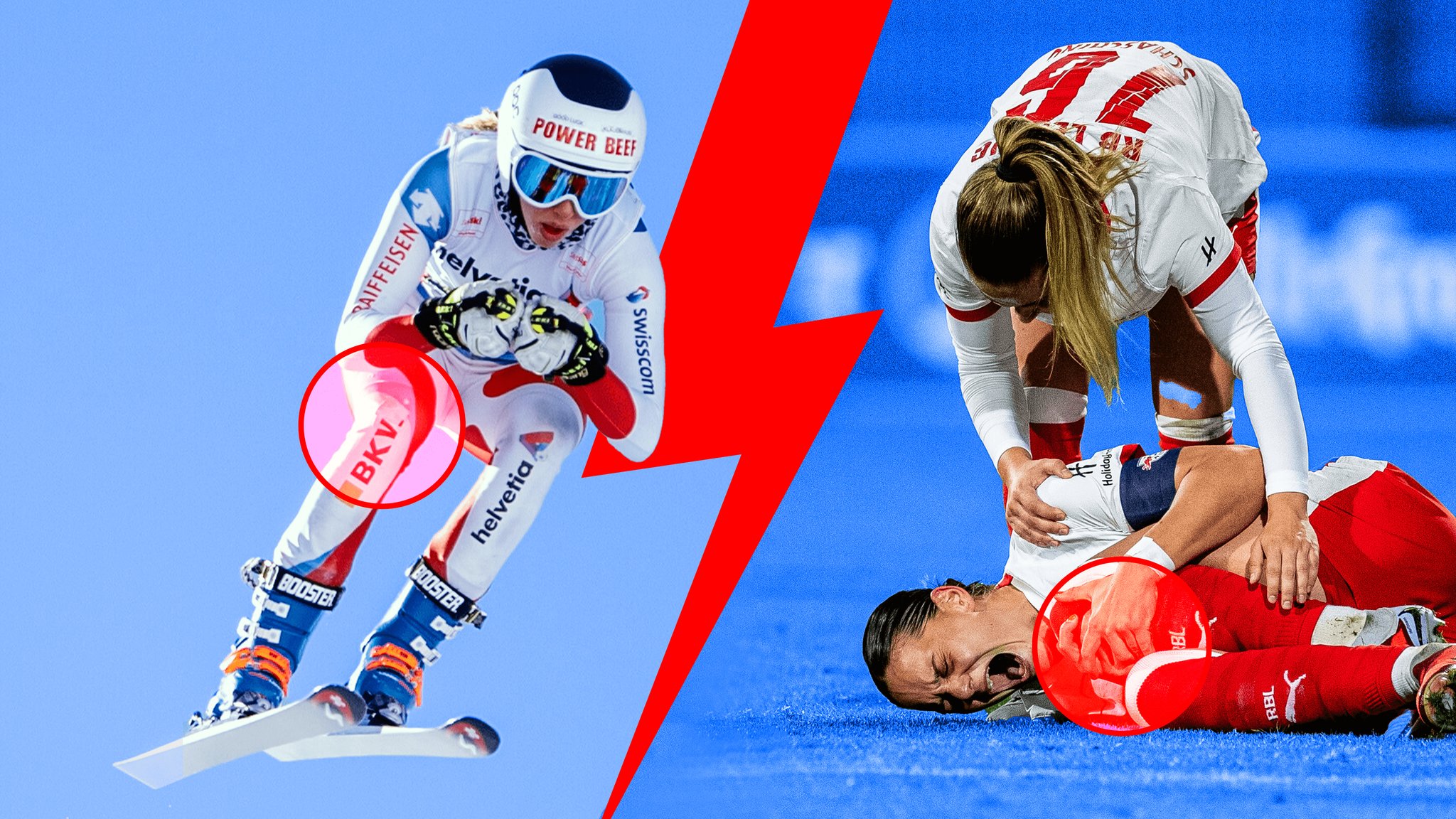 Kreuzbandrisse im Skisport und Fußball: Frauen öfter betroffen? 