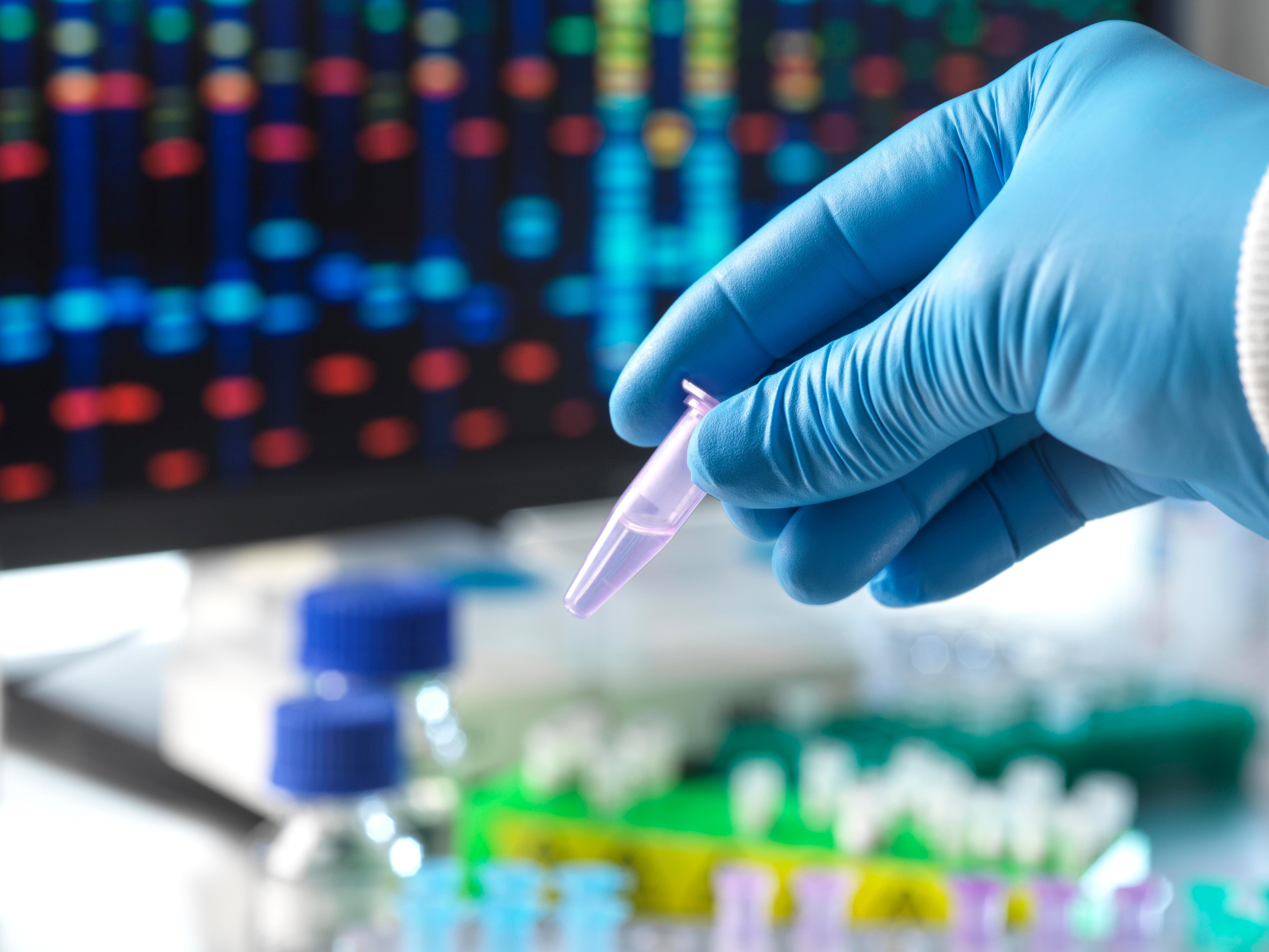 Hand in Handschuh hält eine DNA-Probe in einem Labor