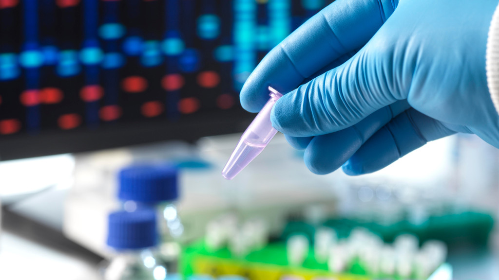 Hand in Handschuh hält eine DNA-Probe in einem Labor