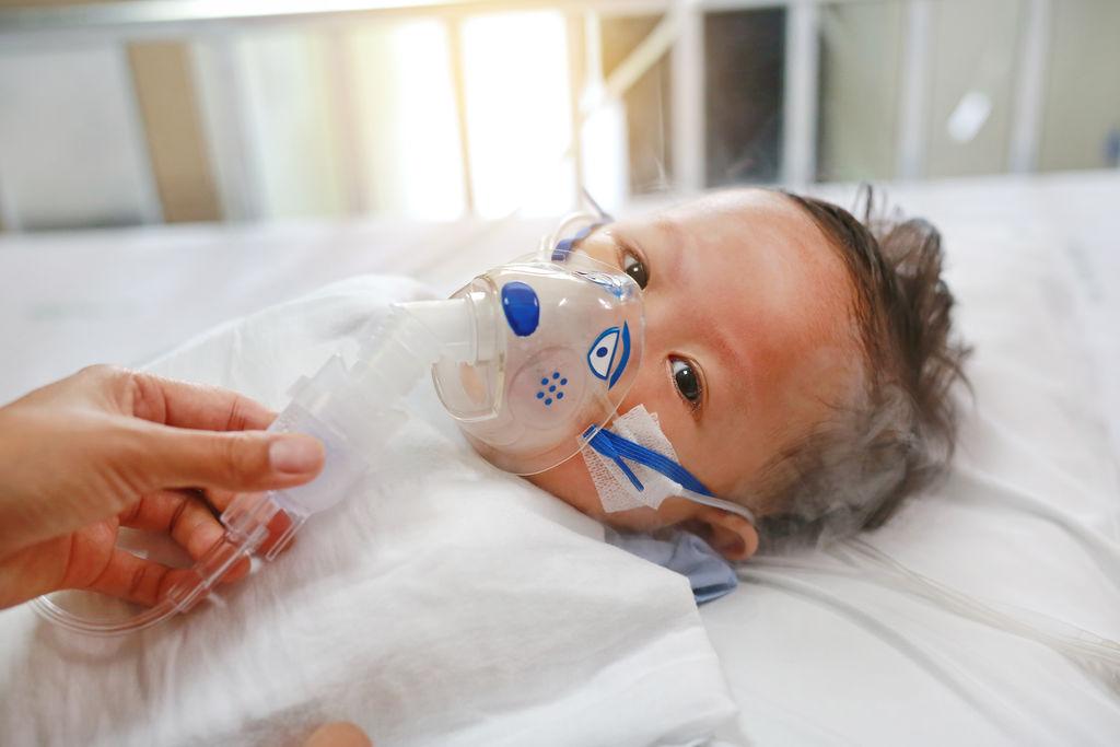 Ein am Respiratorischen Synzytial-Virus (RSV) erkranktes Baby wird im Krankenhaus mit Hilfe einer Inhalationsmaske behandelt.