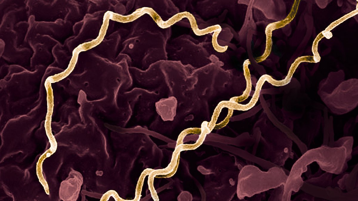 Zahl der Syphilis-Fälle in Bayern steigt weiter an