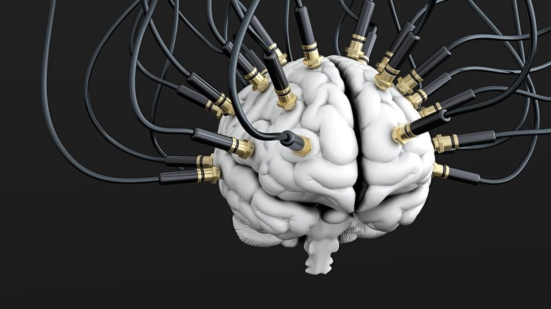 Illustration: an einem Gehirn sind Elektroden angebracht. Mittels Erforschung der Hirnströme ist es Forschern erstmals gelungen, Schmerz objektiv zu vermessen.