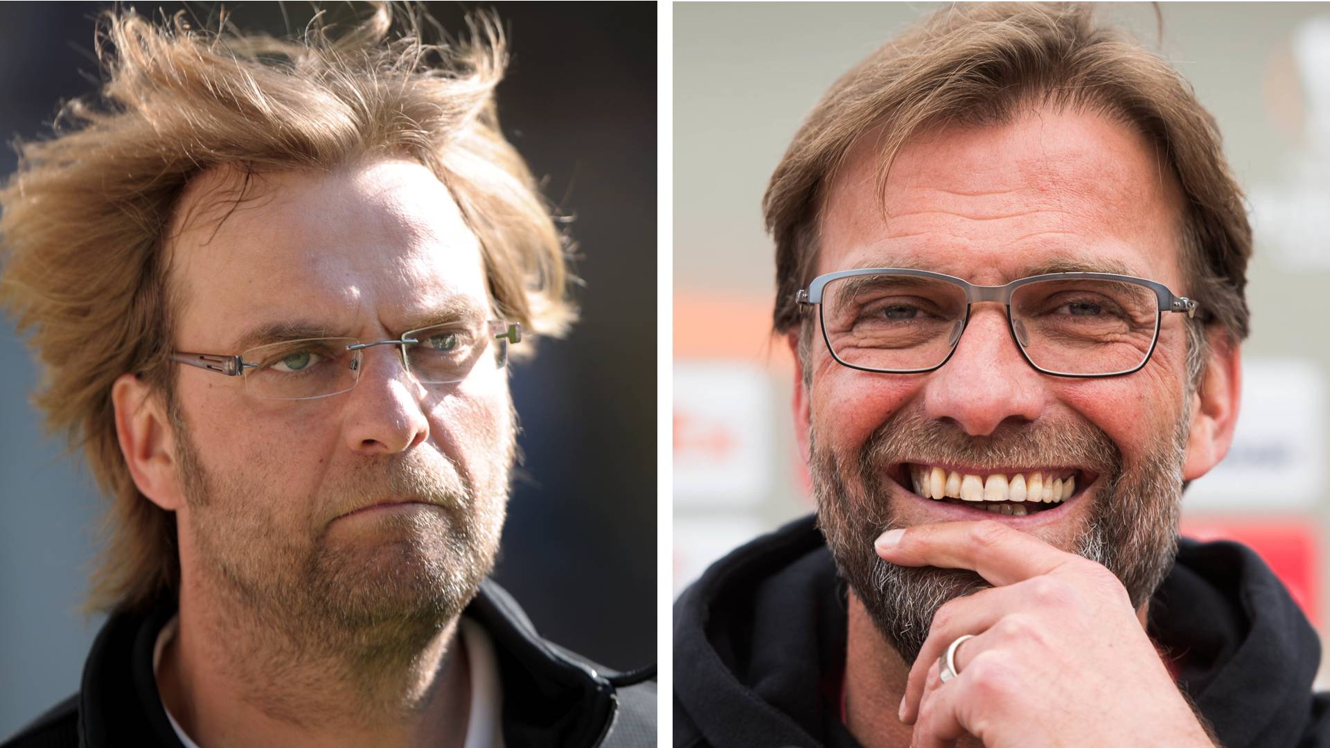 Christoph Metzelder Hat Jetzt Volleres Haar Haartransplantation Diese Promis Haben Die Frisur Getuned Bayern 3