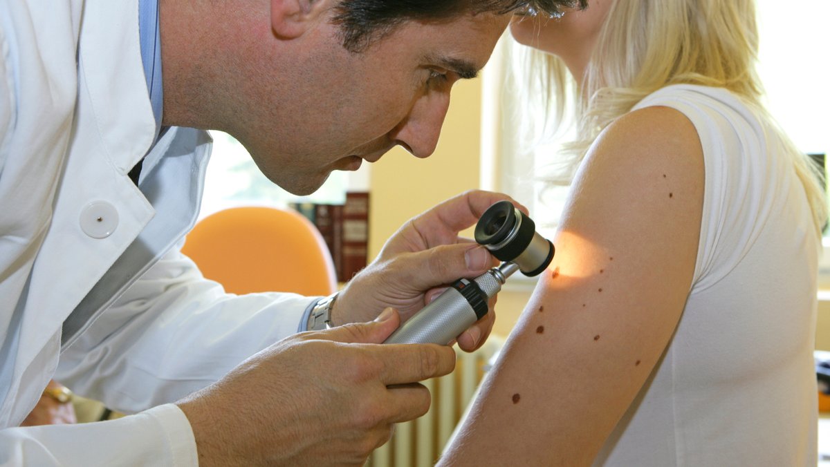 Ein Dermatologe untersucht eine Patientin auf Anzeichen von Hautkrebs. 