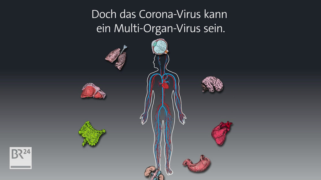 Illustration eines Körpers mit den Stellen, an denen das Virus angreift.