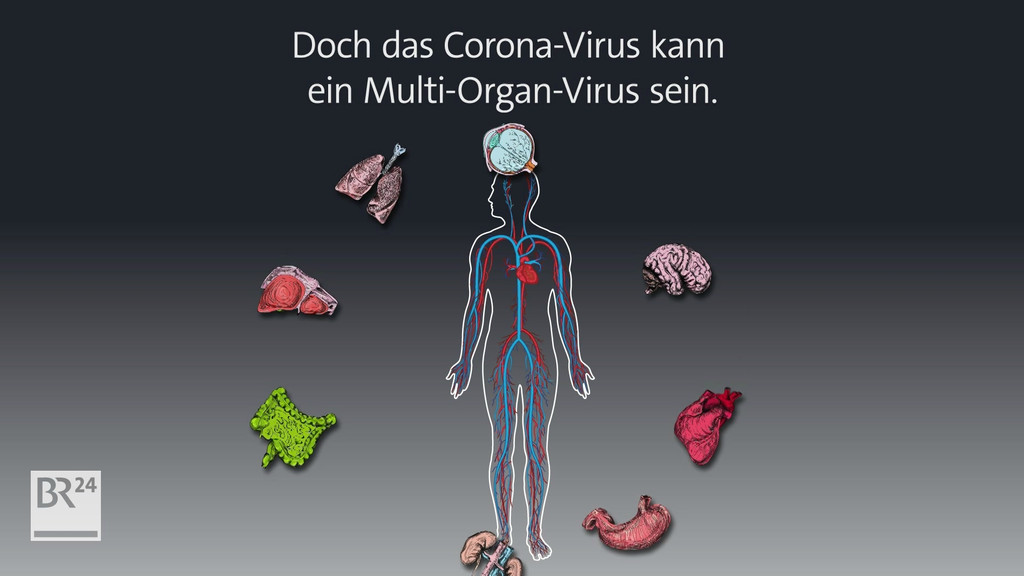 Illustration eines Körpers mit den Stellen, an denen das Virus angreift. | Bild: BR Illustration eines Körpers mit den Stellen, an denen das Virus angreift.