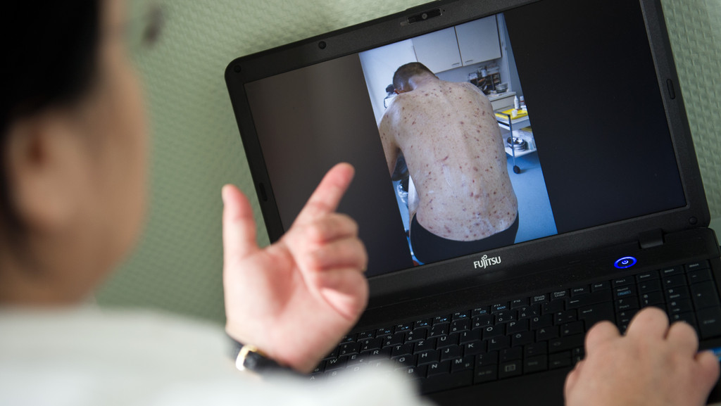 Eine Ärztin zeigt auf ihrem Laptop ein Foto von dem Rücken eines Patienten, der von Krätze befallen ist.