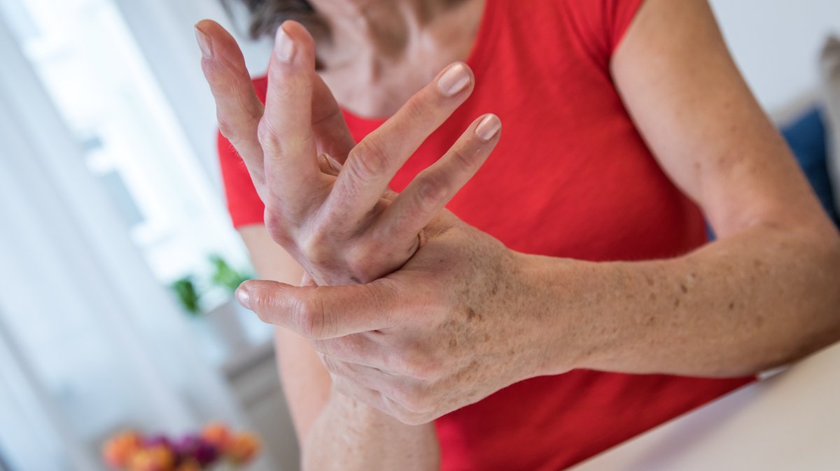 Frau hält sich ihre rheumatischen Hände