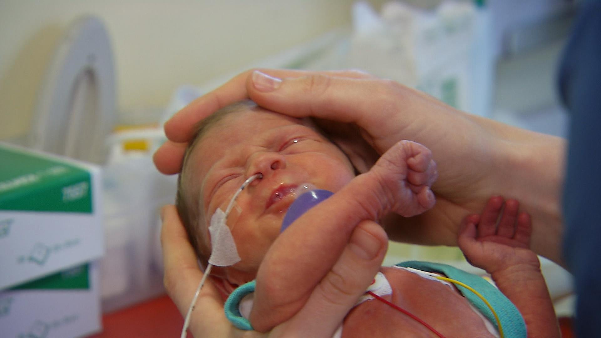 RSV-Impfung bricht Infektionswelle bei Säuglingen