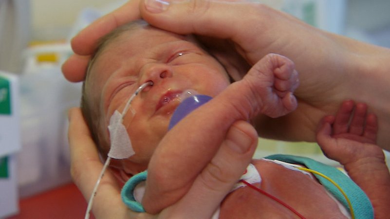 RSV-Impfung bricht Infektionswelle bei Säuglingen | Bild: BR RSV-Impfung bricht Infektionswelle bei Säuglingen