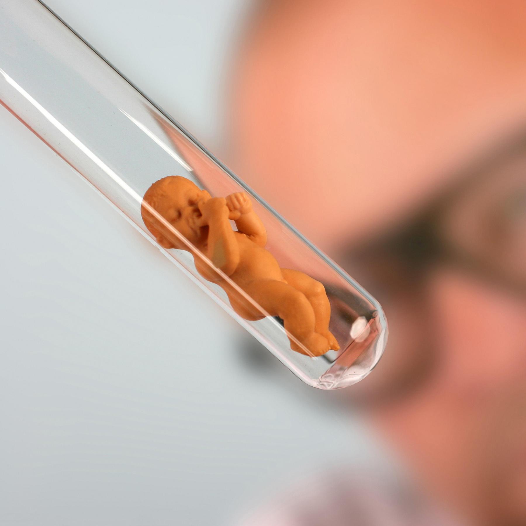 Ein Kind um jeden Preis? - Wenn der Kinderwunsch fragwürdig wird episode artwork