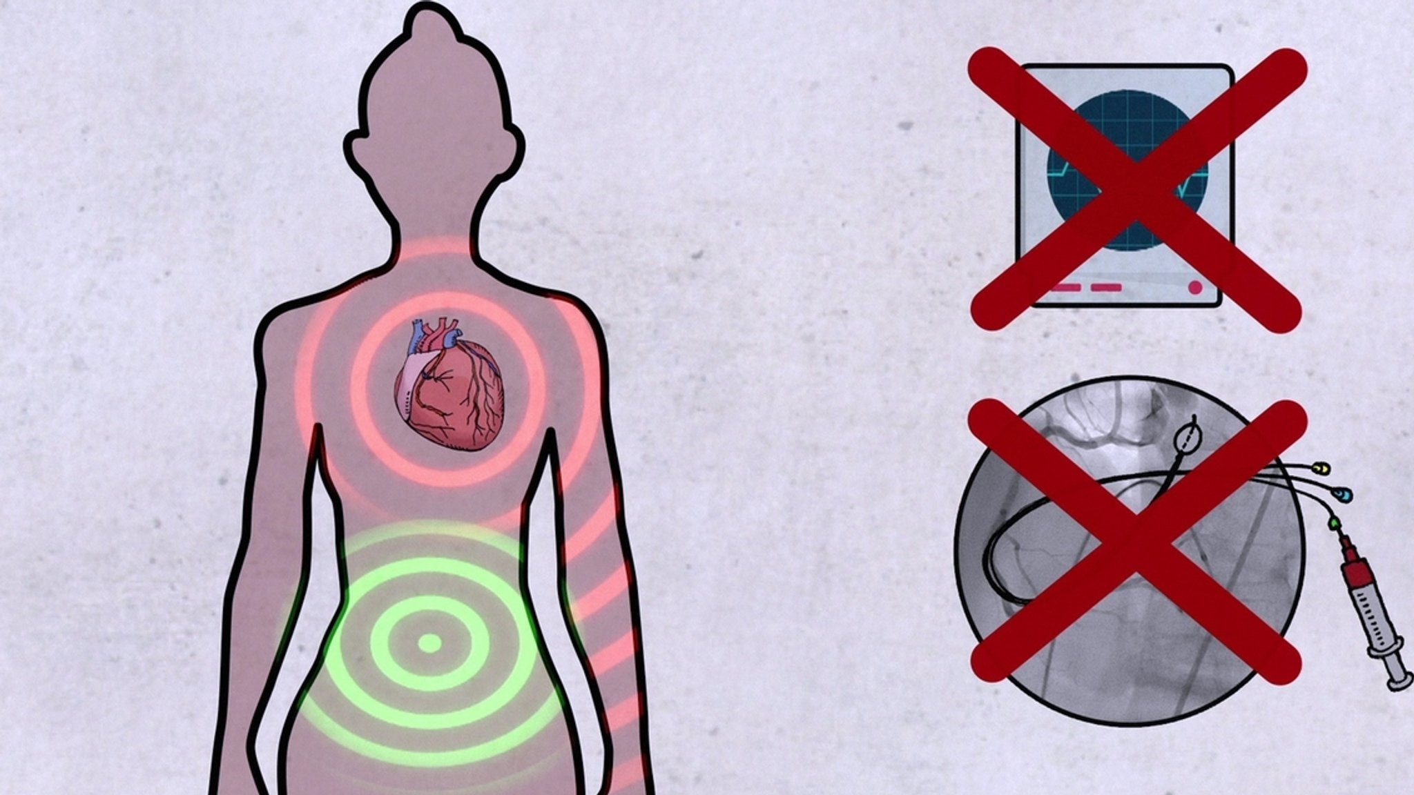 Databias in der Medizin