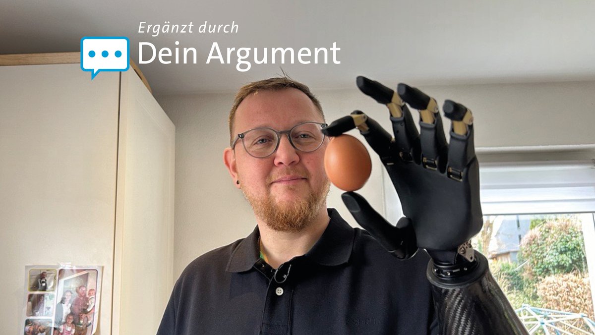 Der Passauer und CRPS-Patient Dominik Müller hält mit seiner Prothese ein rohes Ei. 