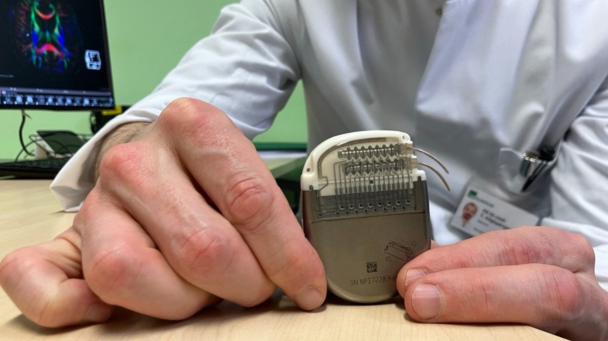 Stimulator-Gerät in grau aus der adaptiven tiefen Hirnstimulationstherapie mit abgeschnittenen Kabeln.