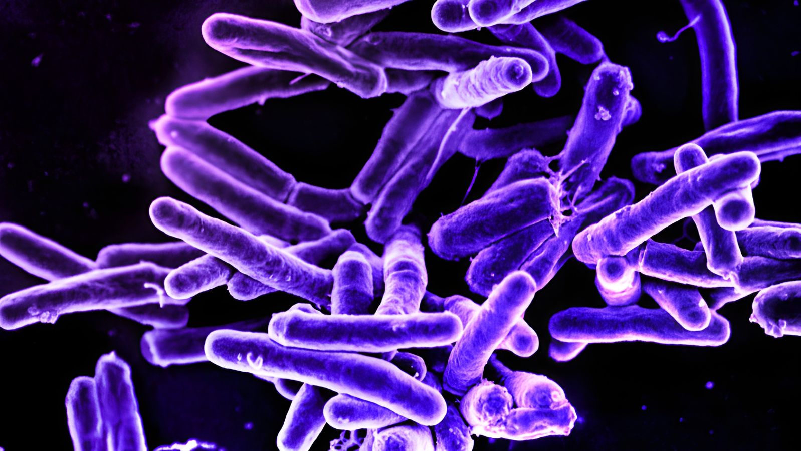 Tuberkulosis – topik lagi dan lagi di Jerman